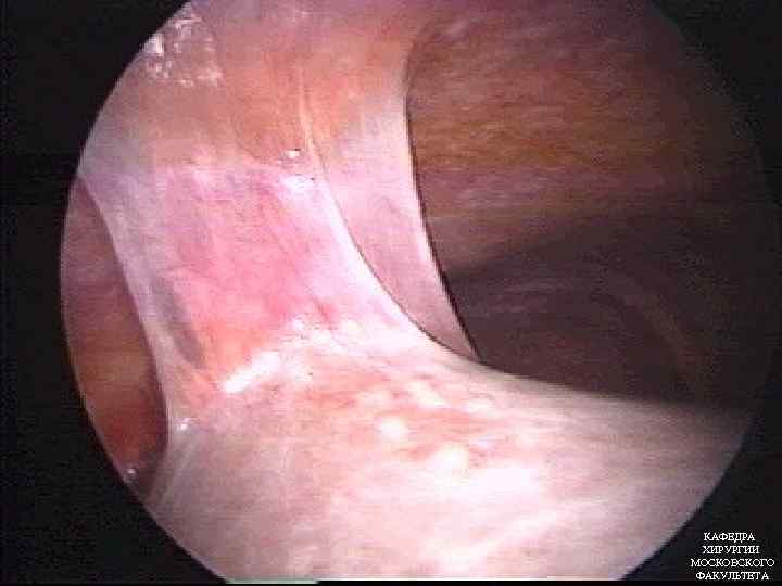 КАФЕДРА ХИРУРГИИ МОСКОВСКОГО ФАКУЛЬТЕТА 