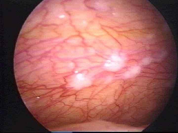 КАФЕДРА ХИРУРГИИ МОСКОВСКОГО ФАКУЛЬТЕТА 