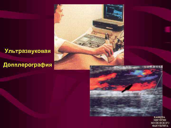 Ультразвуковая Допплерография КАФЕДРА ХИРУРГИИ МОСКОВСКОГО ФАКУЛЬТЕТА 