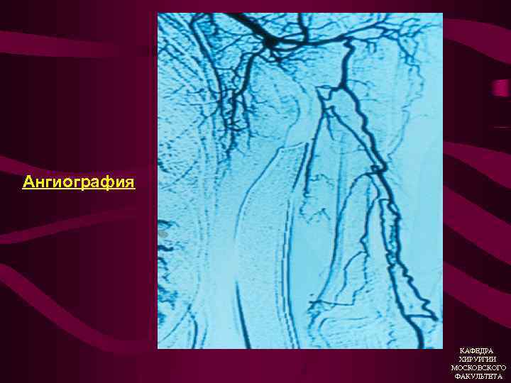 Ангиография КАФЕДРА ХИРУРГИИ МОСКОВСКОГО ФАКУЛЬТЕТА 