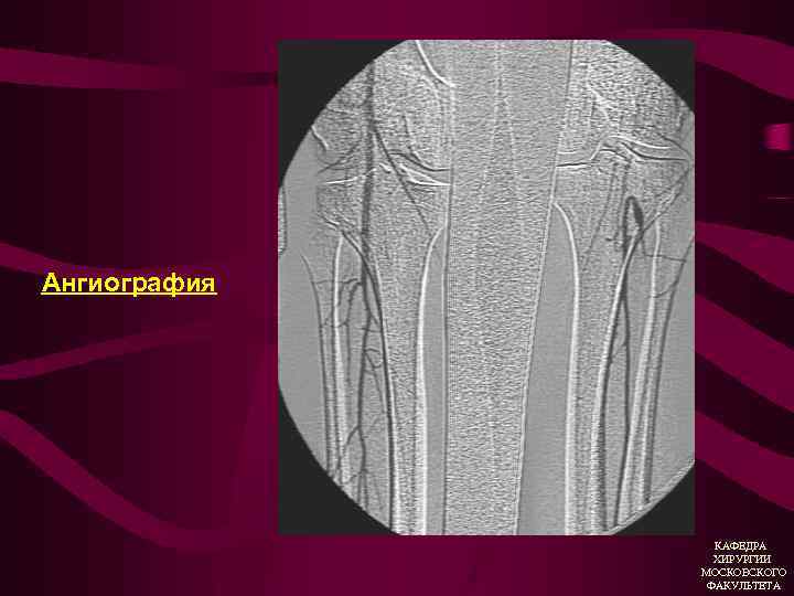 Ангиография КАФЕДРА ХИРУРГИИ МОСКОВСКОГО ФАКУЛЬТЕТА 