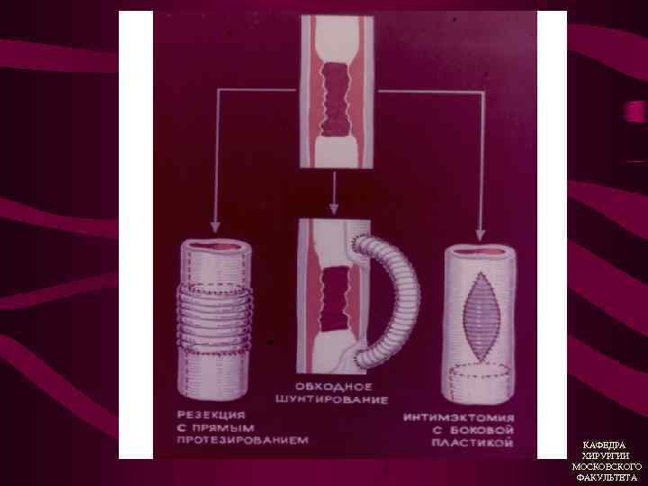 КАФЕДРА ХИРУРГИИ МОСКОВСКОГО ФАКУЛЬТЕТА 