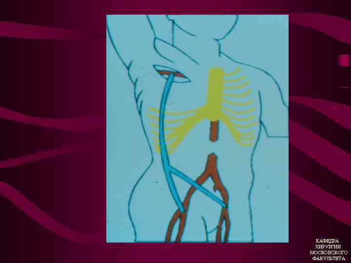 КАФЕДРА ХИРУРГИИ МОСКОВСКОГО ФАКУЛЬТЕТА 