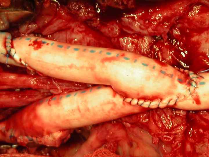 Операция КАФЕДРА ХИРУРГИИ МОСКОВСКОГО ФАКУЛЬТЕТА 