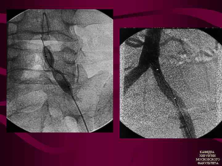 КАФЕДРА ХИРУРГИИ МОСКОВСКОГО ФАКУЛЬТЕТА 