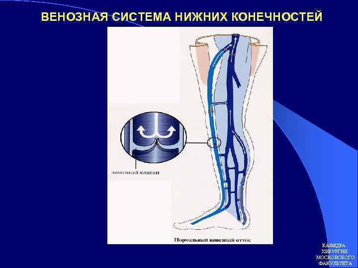 Венозная недостаточность нижних конечностей фото