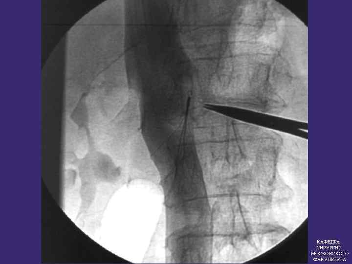 КАФЕДРА ХИРУРГИИ МОСКОВСКОГО ФАКУЛЬТЕТА 