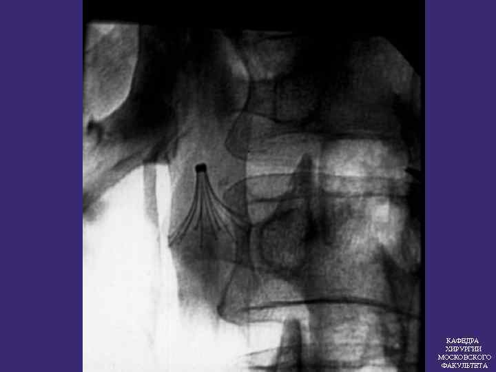 КАФЕДРА ХИРУРГИИ МОСКОВСКОГО ФАКУЛЬТЕТА 