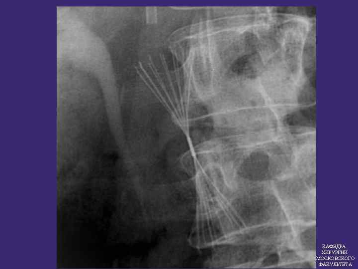 КАФЕДРА ХИРУРГИИ МОСКОВСКОГО ФАКУЛЬТЕТА 