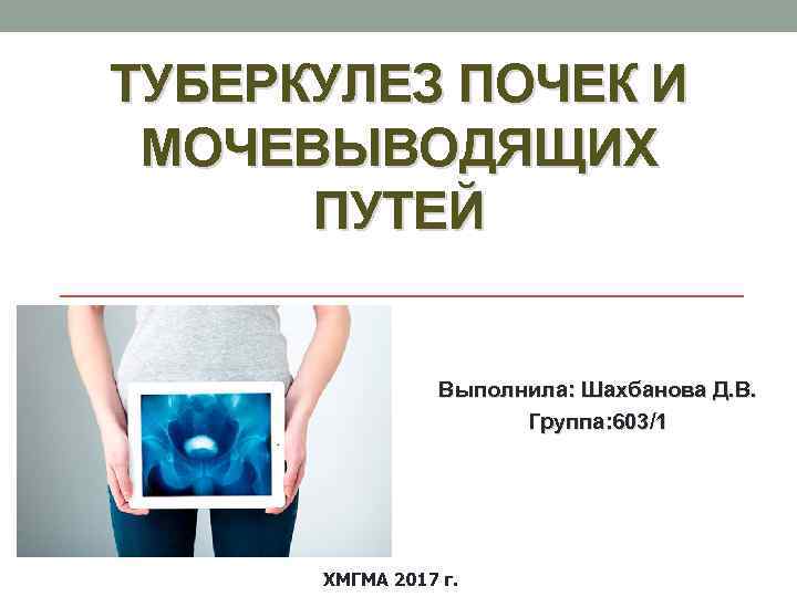 ТУБЕРКУЛЕЗ ПОЧЕК И МОЧЕВЫВОДЯЩИХ ПУТЕЙ Выполнила: Шахбанова Д. В. Группа: 603/1 ХМГМА 2017 г.