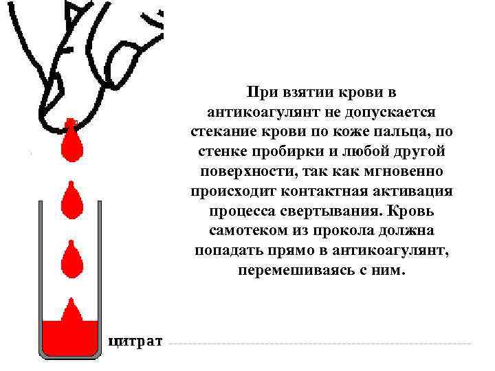 При взятии крови в антикоагулянт не допускается стекание крови по коже пальца, по стенке