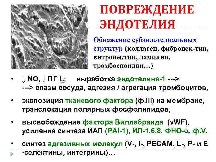 ПОВРЕЖДЕНИЕ ЭНДОТЕЛИЯ Обнажение субэндотелиальных структур (коллаген, фибронек-тин, витронектин, ламилин, тромбоспондин…) • ↓ NO, ↓