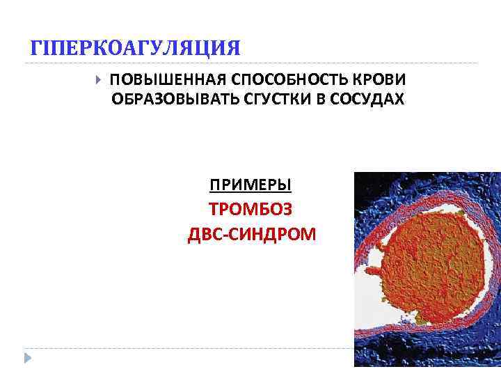 ГІПЕРКОАГУЛЯЦИЯ ПОВЫШЕННАЯ СПОСОБНОСТЬ КРОВИ ОБРАЗОВЫВАТЬ СГУСТКИ В СОСУДАХ ПРИМЕРЫ ТРОМБОЗ ДВС-СИНДРОМ 