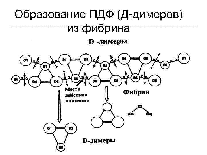 Образование ПДФ (Д-димеров) из фибрина 