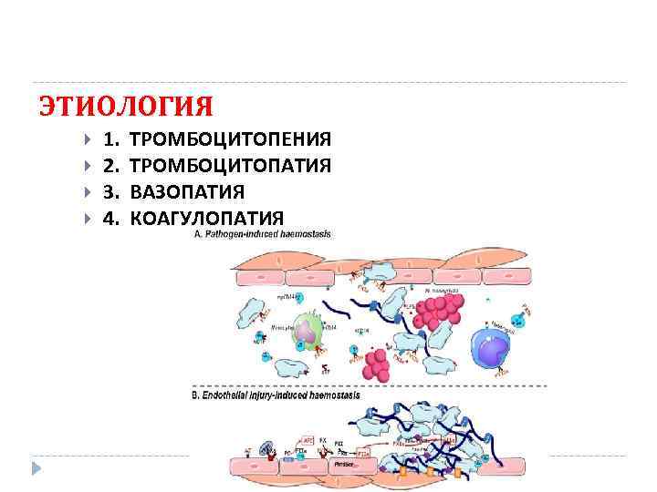 ЭТИОЛОГИЯ 1. ТРОМБОЦИТОПЕНИЯ 2. ТРОМБОЦИТОПАТИЯ 3. ВАЗОПАТИЯ 4. КОАГУЛОПАТИЯ 