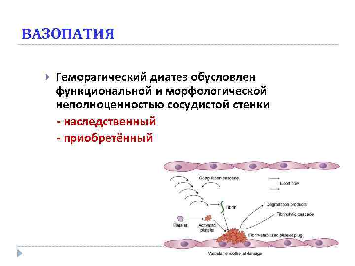 ВАЗОПАТИЯ Геморагический диатез обусловлен функциональной и морфологической неполноценностью сосудистой стенки - наследственный - приобретённый