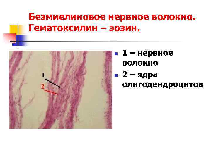 Безмиелиновое нервное волокно. Гематоксилин – эозин. n n 1 – нервное волокно 2 –