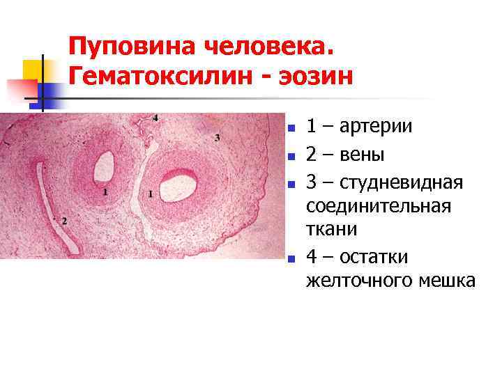 Сосуды пуповины