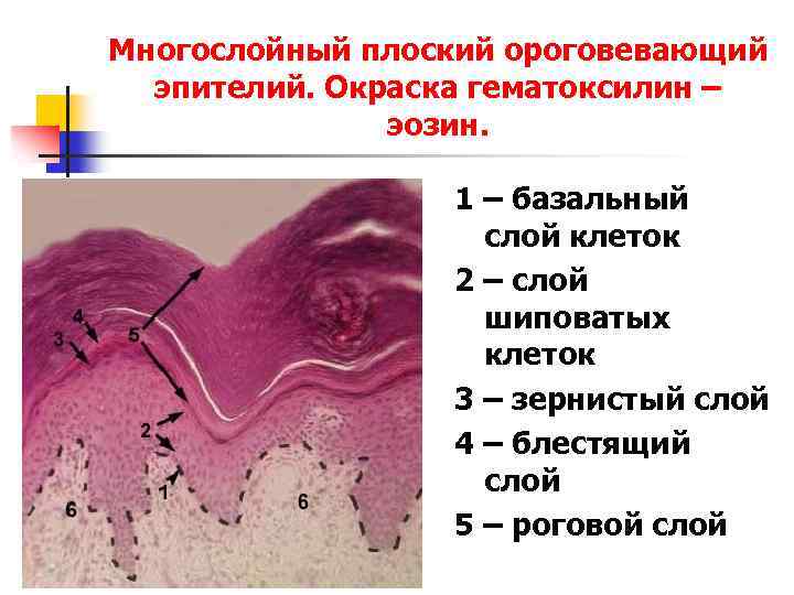 Многослойный ороговевающий эпителий. Многослойный плоский ороговевающий эпителий кожи пальца. Многослойный плоский ороговевающий эпителий местоположение. Многослойный ороговевающий эпителий строение. Многослойный ороговевающий эпителий местонахождение.