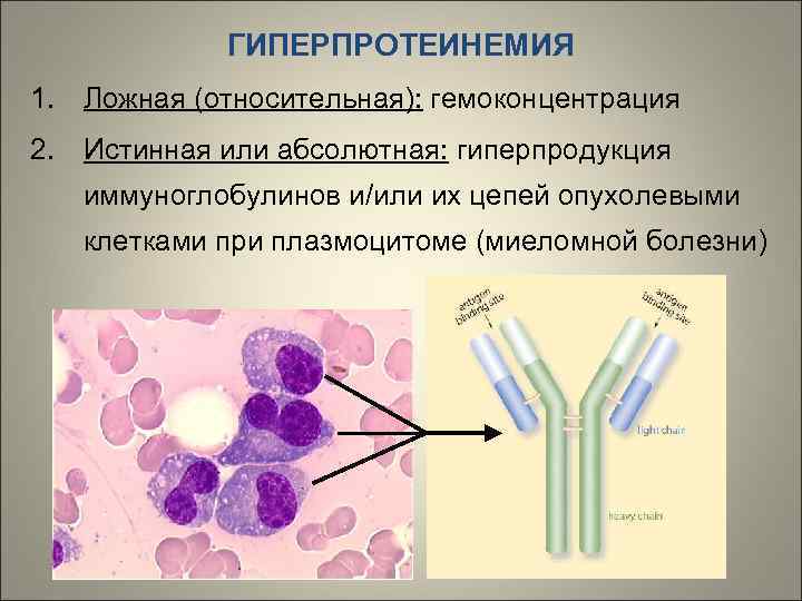 ГИПЕРПРОТЕИНЕМИЯ 1. Ложная (относительная): гемоконцентрация 2. Истинная или абсолютная: гиперпродукция иммуноглобулинов и/или их цепей