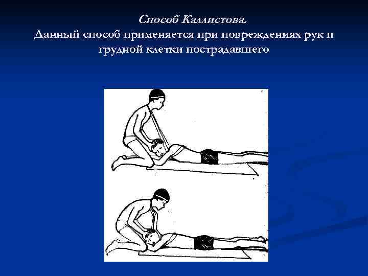 Способ Каллистова. Данный способ применяется при повреждениях рук и грудной клетки пострадавшего 