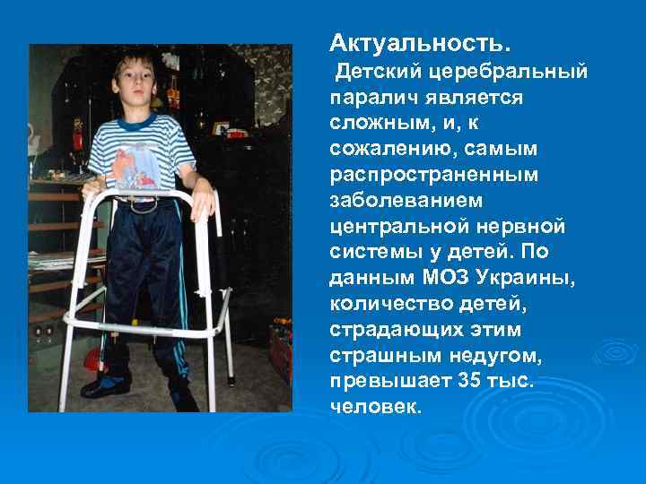 Актуальность. Детский церебральный паралич является сложным, и, к сожалению, самым распространенным заболеванием центральной нервной