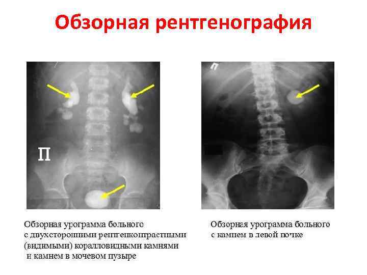 306ps двигатель болезни