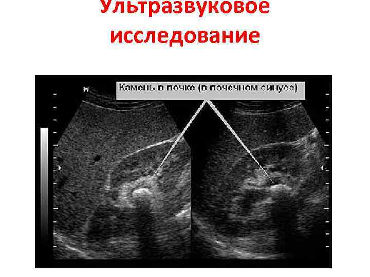 Ультразвуковое исследование 