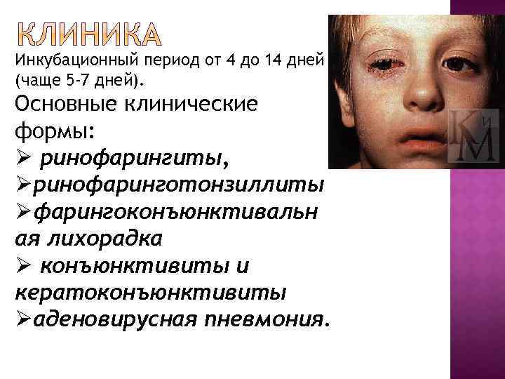Инкубационный период от 4 до 14 дней (чаще 5 -7 дней). Основные клинические формы: