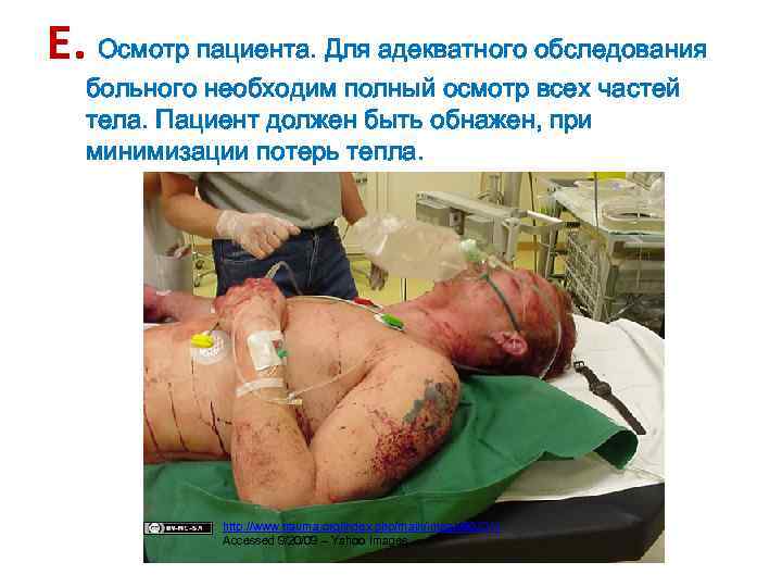 E. Осмотр пациента. Для адекватного обследования больного необходим полный осмотр всех частей тела. Пациент