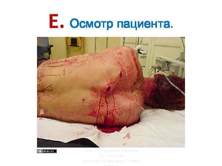 E. Осмотр пациента. Ghana Emergency Medicine http: //www. trauma. org/images/image_library/chest 0044 b. jpg Collaborative