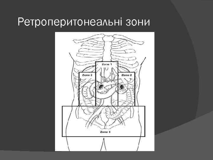 Ретроперитонеальні зони 