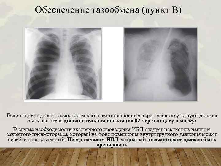 Обеспечение газообмена (пункт В) Если пациент дышит самостоятельно и вентиляционные нарушения отсутствуют должна быть