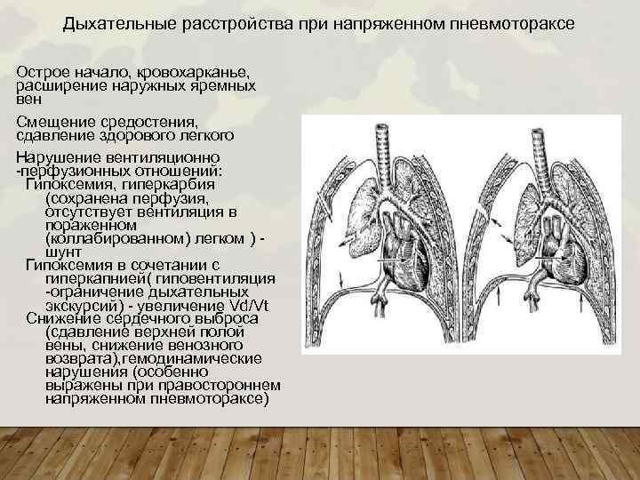 Напряженный пневмоторакс. Пневмоторакс механизм расстройства дыхания. При открытом пневмотораксе средостение открытый пневмоторакс. При напряженном пневмотораксе средостение. При открытом пневмотораксе средостение смещено.