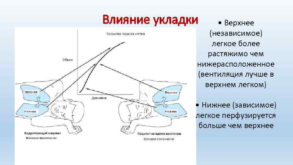 Влияние укладки • Верхнее (независимое) легкое более растяжимо чем нижерасположенное (вентиляция лучше в верхнем