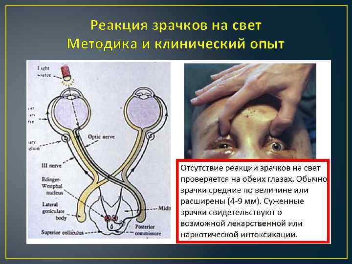 Реакция зрачков на свет Методика и клинический опыт 