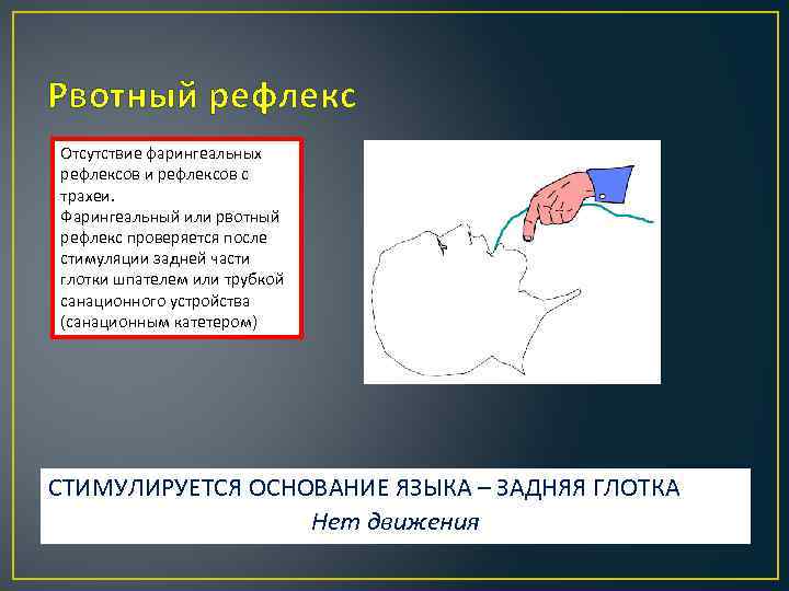 Рвотный рефлекс Отсутствие фарингеальных рефлексов и рефлексов с трахеи. Фарингеальный или рвотный рефлекс проверяется