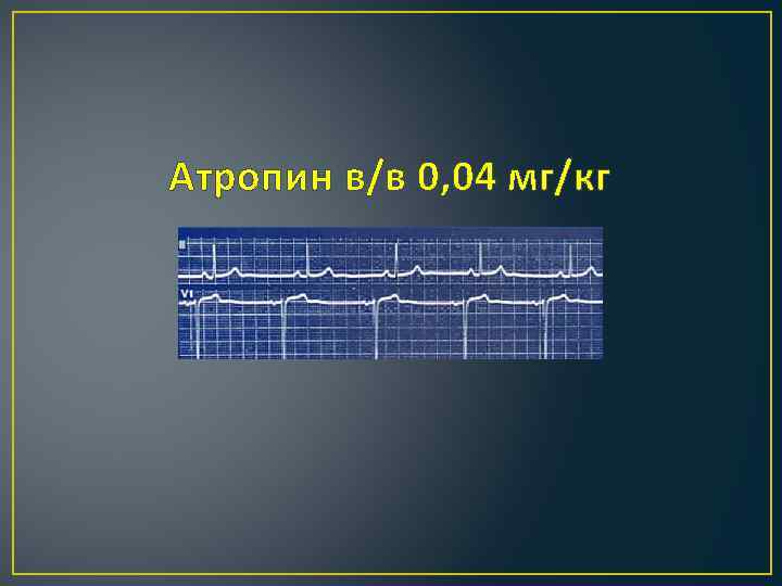 Атропин в/в 0, 04 мг/кг 