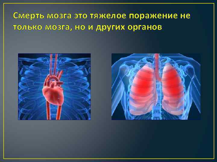 Смерть мозга это тяжелое поражение не только мозга, но и других органов 