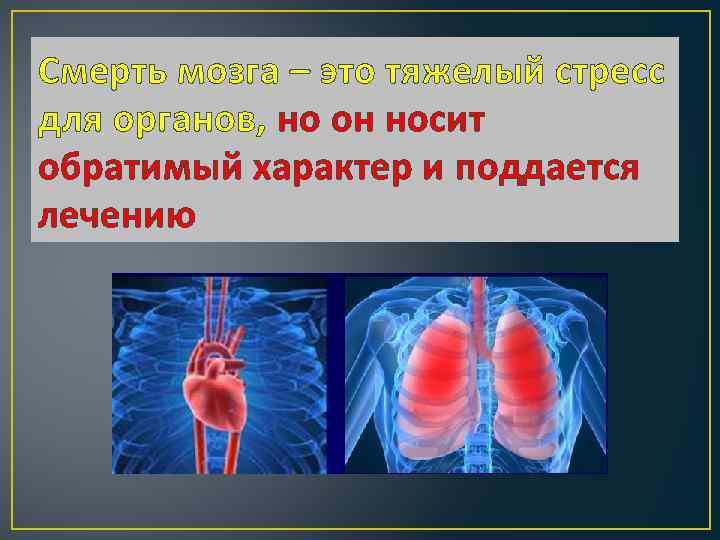 Смерть мозга – это тяжелый стресс для органов, но он носит обратимый характер и