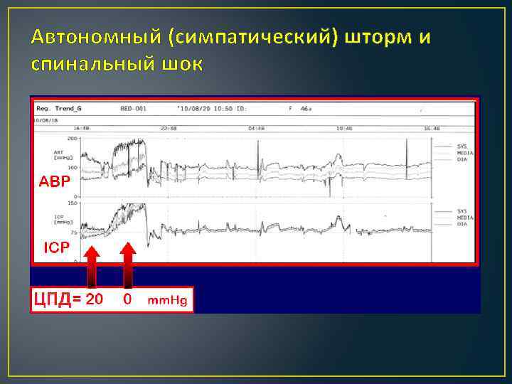 Автономный (симпатический) шторм и спинальный шок 