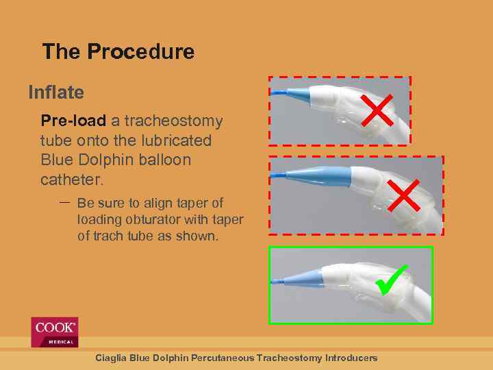 The Procedure Inflate Pre-load a tracheostomy tube onto the lubricated Blue Dolphin balloon catheter.