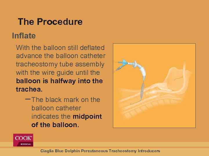 The Procedure Inflate With the balloon still deflated advance the balloon catheter tracheostomy tube