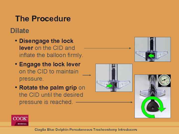 The Procedure Dilate • Disengage the lock lever on the CID and inflate the