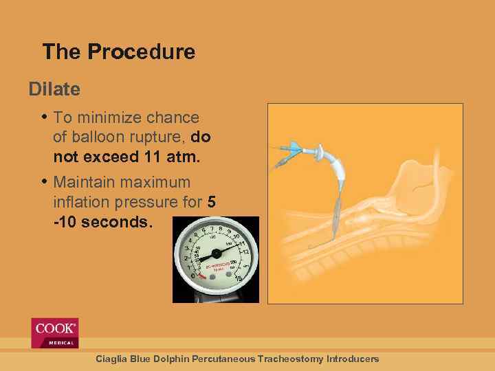 The Procedure Dilate • To minimize chance of balloon rupture, do not exceed 11