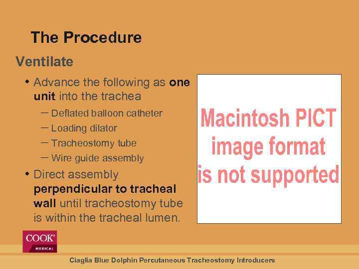 The Procedure Ventilate • Advance the following as one unit into the trachea Deflated