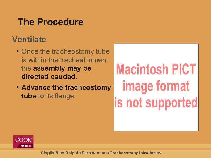 The Procedure Ventilate • Once the tracheostomy tube is within the tracheal lumen the