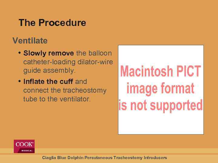 The Procedure Ventilate • Slowly remove the balloon catheter-loading dilator-wire guide assembly. • Inflate