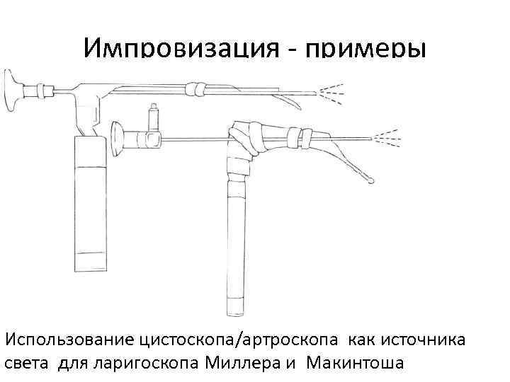 Импровизация - примеры Использование цистоскопа/артроскопа как источника света для ларигоскопа Миллера и Макинтоша 