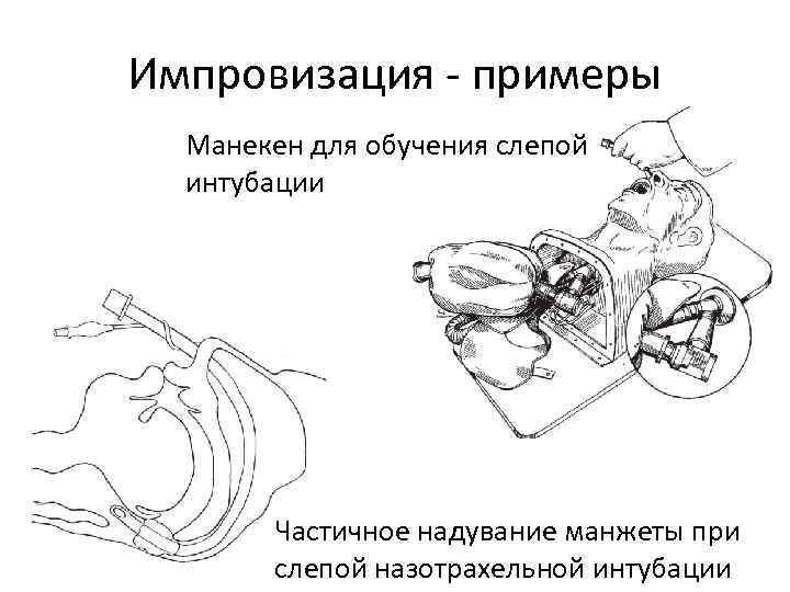 Импровизация - примеры Манекен для обучения слепой интубации Частичное надувание манжеты при слепой назотрахельной